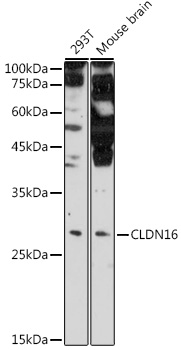 Western blot analysis of extracts of various cell lines using CLDN16 Polyclonal Antibody at 1:500 dilution.