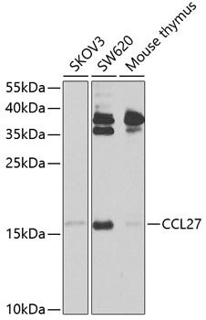 Western blot analysis of extracts of various cell lines using CCL27 Polyclonal Antibody at 1:1000 dilution.