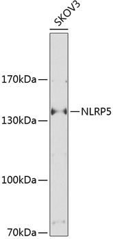 Western blot analysis of extracts of SKOV3 cells using NLRP5 Polyclonal Antibody at 1:1000 dilution.