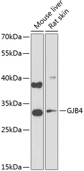 Western blot analysis of extracts of various cell lines using GJB4 Polyclonal Antibody at 1:1000 dilution.