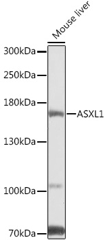 Western blot analysis of extracts of Mouse liver using ASXL1 Polyclonal Antibody at 1:1000 dilution.