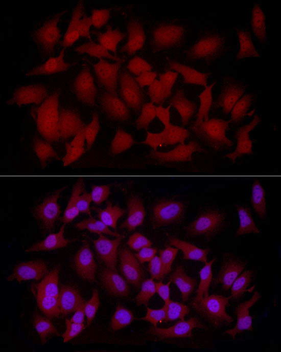 Immunofluorescence analysis of HeLa cells using CAMKK2 Polyclonal Antibody at dilution of 1:50 (40x lens). Blue: DAPI for nuclear staining.