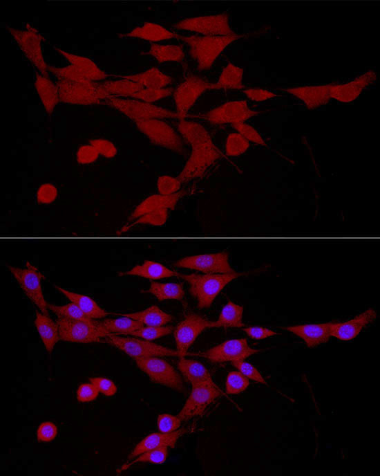 Immunofluorescence analysis of NIH/3T3 cells using CAMKK2 Polyclonal Antibody at dilution of 1:50 (40x lens). Blue: DAPI for nuclear staining.