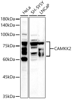 Western blot analysis of extracts of various cell lines using CAMKK2 Polyclonal Antibody at 1:500 dilution.