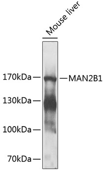 Western blot analysis of extracts of mouse liver using MAN2B1 Polyclonal Antibody at 1:1000 dilution.