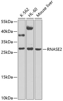 Western blot analysis of extracts of various cell lines using RNASE2 Polyclonal Antibody at 1:1000 dilution.