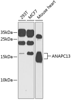 Western blot analysis of extracts of various cell lines using ANAPC13 Polyclonal Antibody at 1:1000 dilution.