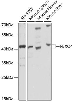 Western blot analysis of extracts of various cell lines using FBXO4 Polyclonal Antibody at 1:1000 dilution.