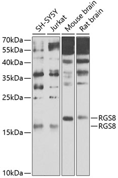 Western blot analysis of extracts of various cell lines using RGS8 Polyclonal Antibody at 1:1000 dilution.