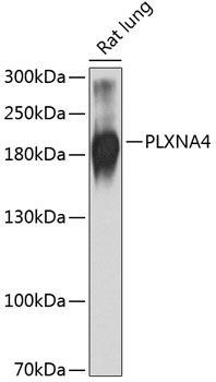 Western blot analysis of extracts of rat lung using PLXNA4 Polyclonal Antibody at 1:1000 dilution.