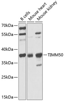 Western blot analysis of extracts of various cell lines using TIMM50 Polyclonal Antibody at 1:1000 dilution.