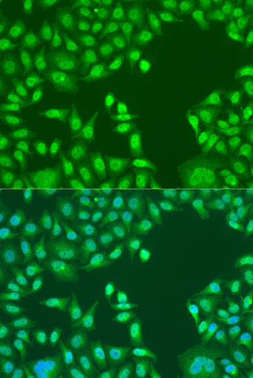 Immunofluorescence analysis of U2OS cells using PTEN Polyclonal Antibody at dilution of 1:100. Blue: DAPI for nuclear staining.