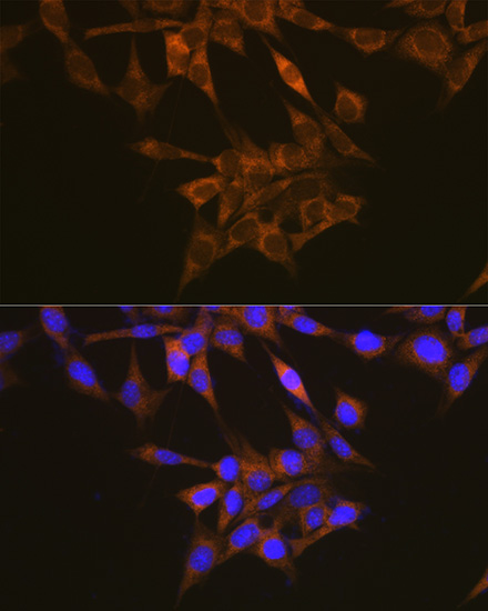 Immunofluorescence analysis of NIH/3T3 cells using VEGFR1 Polyclonal Antibody at dilution of 1:100. Blue: DAPI for nuclear staining.