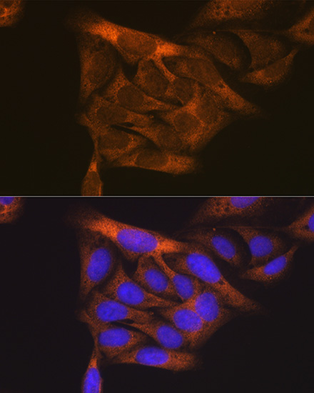 Immunofluorescence analysis of U2OS cells using VEGFR1 Polyclonal Antibody at dilution of 1:100. Blue: DAPI for nuclear staining.