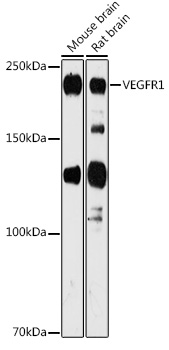 Western blot analysis of extracts of various cell lines using VEGFR1 Polyclonal Antibody at 1:1000 dilution.