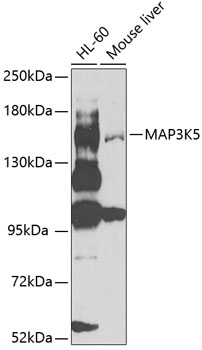 Western blot analysis of extracts of various cell lines using MAP3K5 Polyclonal Antibody at 1:1000 dilution.