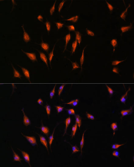 Immunofluorescence analysis of L929 cells using MMP9 Polyclonal Antibody at dilution of 1:100. Blue: DAPI for nuclear staining.