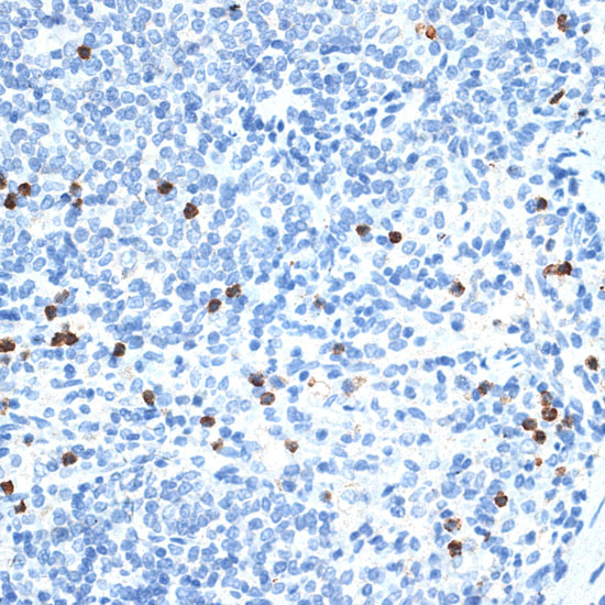 Immunohistochemistry of paraffin-embedded rat spleen using MMP9 Polyclonal Antibody at dilution of 1:100 (40x lens).Perform microwave antigen retrieval with 10 mM PBS buffer pH 7.2 before commencing with IHC staining protocol.