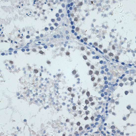 Immunohistochemistry of paraffin-embedded mouse spleen using MMP9 Polyclonal Antibody at dilution of 1:100 (40x lens).Perform microwave antigen retrieval with 10 mM PBS buffer pH 7.2 before commencing with IHC staining protocol.