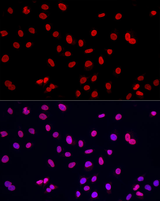 Immunofluorescence analysis of A-549 cells using Lamin A/C Polyclonal Antibody at dilution of 1:100 (40x lens). Blue: DAPI for nuclear staining.