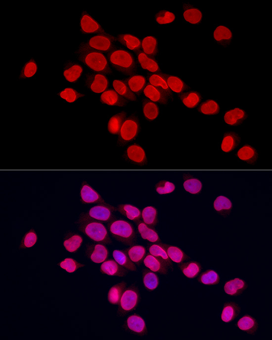 Immunofluorescence analysis of HeLa cells using Lamin A/C Polyclonal Antibody at dilution of 1:100 (40x lens). Blue: DAPI for nuclear staining.