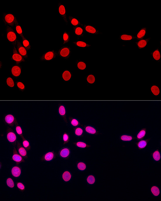 Immunofluorescence analysis of NIH/3T3 cells using Lamin A/C Polyclonal Antibody at dilution of 1:100 (40x lens). Blue: DAPI for nuclear staining.