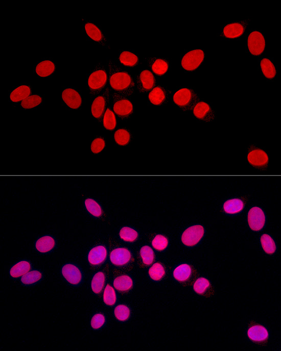 Immunofluorescence analysis of PC-12 cells using Lamin A/C Polyclonal Antibody at dilution of 1:100 (40x lens). Blue: DAPI for nuclear staining.