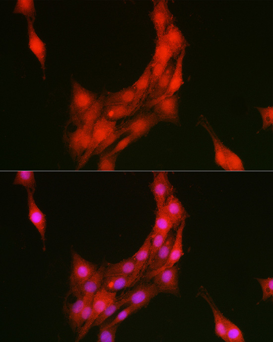 Immunofluorescence analysis of PC-12 cells using [KO Validated] ANXA1 Polyclonal Antibody at dilution of 1:100 (40x lens). Blue: DAPI for nuclear staining.