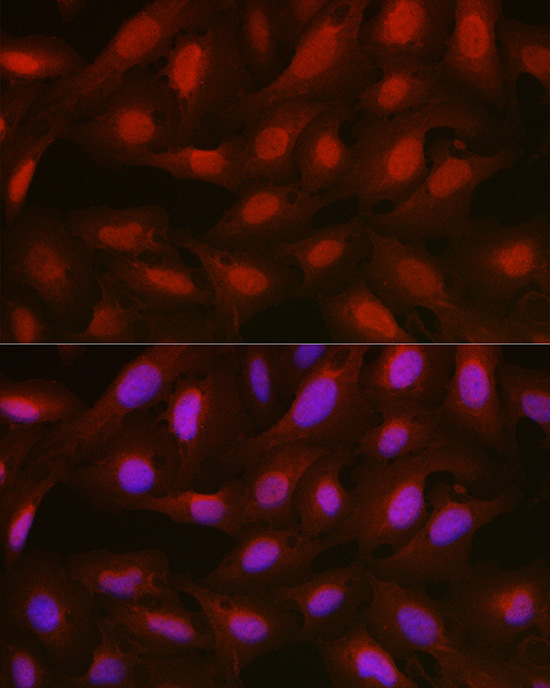 Immunofluorescence analysis of U2OS cells using [KO Validated] ANXA1 Polyclonal Antibody at dilution of 1:100 (40x lens). Blue: DAPI for nuclear staining.