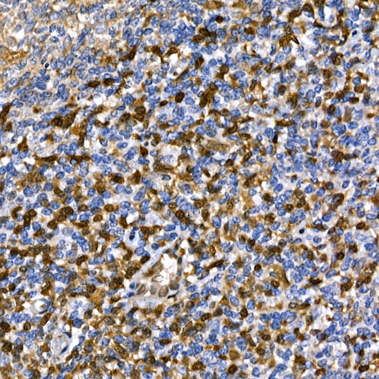 Immunohistochemistry of paraffin-embedded human tonsil using [KO Validated] ANXA1 Polyclonal Antibody at dilution of 1:100 (40x lens).Perform high pressure antigen retrieval with 10 mM citrate buffer pH 6.0 before commencing with IHC staining protocol.