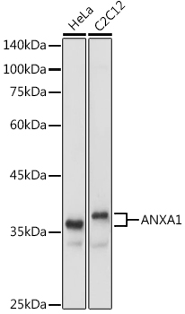 Western blot analysis of extracts of various cell lines using ANXA1 Polyclonal Antibody at 1:1000 dilution.