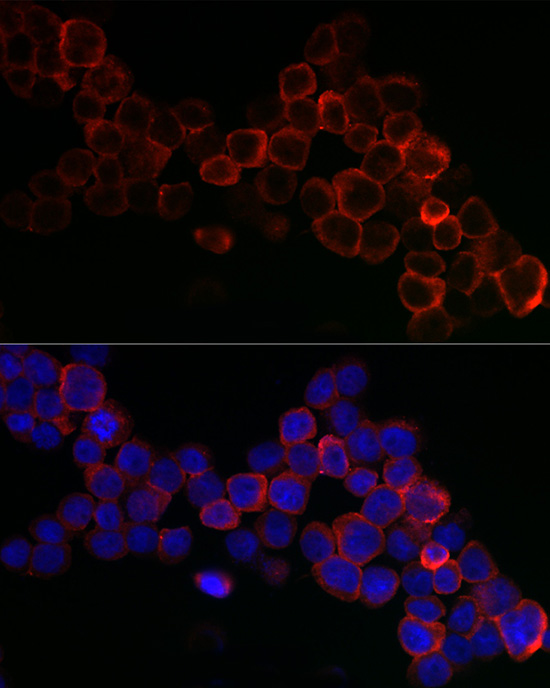 Immunofluorescence analysis of THP-1 cells using GPX1 Polyclonal Antibody at dilution of 1:200. Blue: DAPI for nuclear staining.