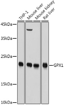 Western blot analysis of extracts of various cell lines using GPX1 Polyclonal Antibody at 1:1000 dilution.