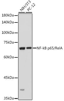 Western blot analysis of extracts of various cell lines using NF-kB p65/RelA Polyclonal Antibody at 1:1000 dilution.