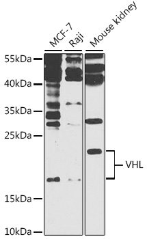 Western blot analysis of extracts of various cell lines using VHL Polyclonal Antibody at 1:1000 dilution.