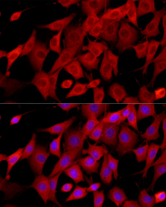 Immunofluorescence analysis of NIH/3T3 using CTGF Polyclonal Antibody at dilution of 1 : 150 (40x lens). Blue: DAPI for nuclear staining.