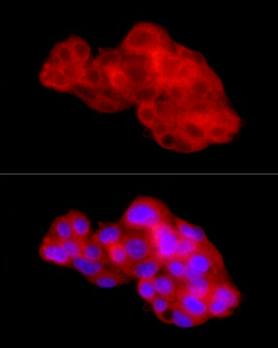 Immunofluorescence analysis of HepG2 using CTGF Polyclonal Antibody at dilution of 1 : 150 (40x lens). Blue: DAPI for nuclear staining.