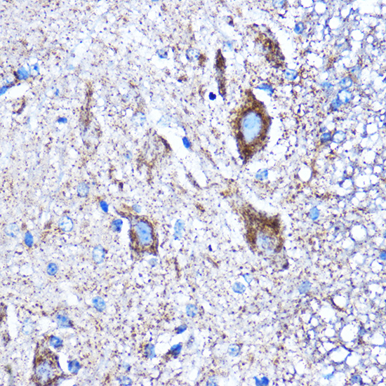 Immunohistochemistry of paraffin-embedded Mouse spinal cord using CTGF Polyclonal Antibody at dilution of 1:100 (40x lens).Perform microwave antigen retrieval with 10 mM PBS buffer pH 7.2 before commencing with IHC staining protocol.