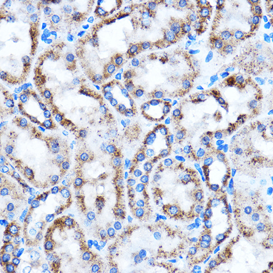 Immunohistochemistry of paraffin-embedded Rat kidney using CTGF Polyclonal Antibody at dilution of 1:100 (40x lens).Perform microwave antigen retrieval with 10 mM PBS buffer pH 7.2 before commencing with IHC staining protocol.