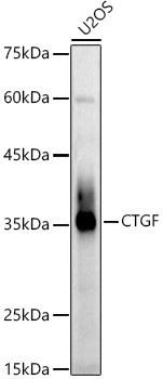 Western blot analysis of extracts of U2OS cells using CTGF Polyclonal Antibody at 1:1000 dilution.