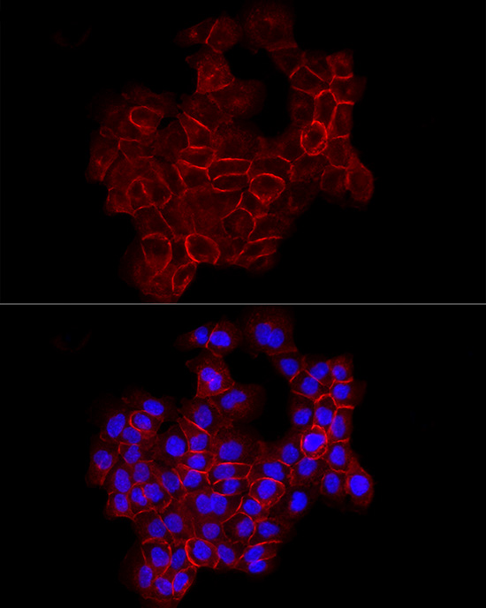 Immunofluorescence analysis of A-431 cells using E-Cadherin Polyclonal Antibody at dilution of 1:100 (40x lens). Blue: DAPI for nuclear staining.