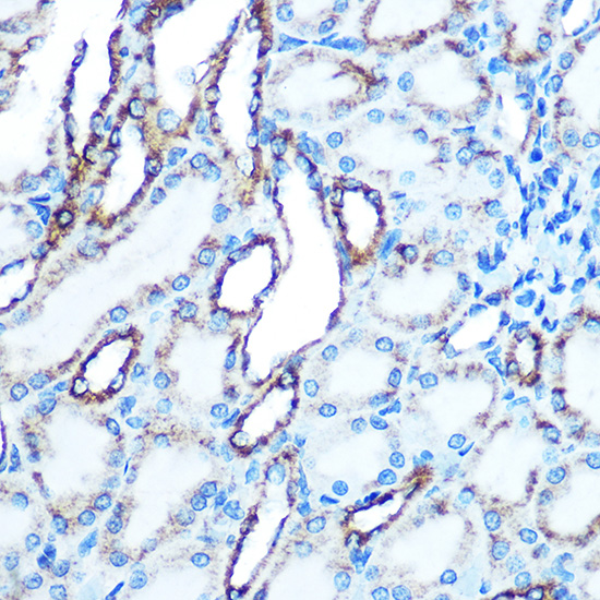 Immunohistochemistry of paraffin-embedded Rat kidney using E-Cadherin Polyclonal Antibody at dilution of 1:50 (40x lens).Perform microwave antigen retrieval with 10 mM Tris/EDTA buffer pH 9.0 before commencing with IHC staining protocol.