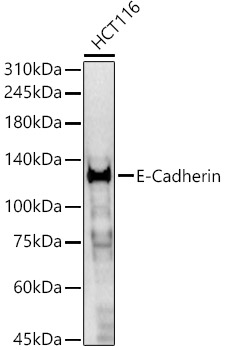 Western blot analysis of HCT116 using E-Cadherin Polyclonal Antibody at 1:400 dilution.
