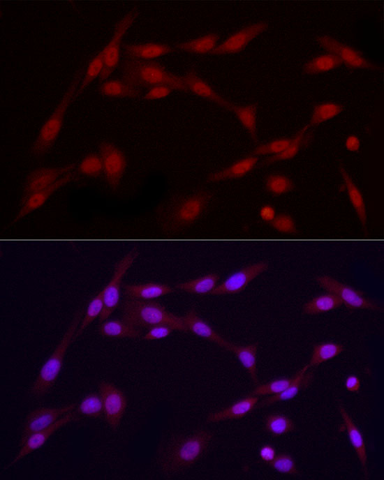 Immunofluorescence analysis of PC-12 using VDR Polyclonal Antibody at dilution of 1 : 100 (40x lens). Blue: DAPI for nuclear staining.