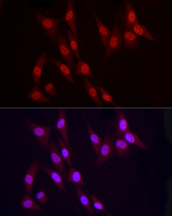 Immunofluorescence analysis of NIH-3T3 using VDR Polyclonal Antibody at dilution of 1 : 100 (40x lens). Blue: DAPI for nuclear staining.