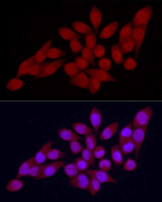 Immunofluorescence analysis of HeLa using VDR Polyclonal Antibody at dilution of 1 : 100 (40x lens). Blue: DAPI for nuclear staining.