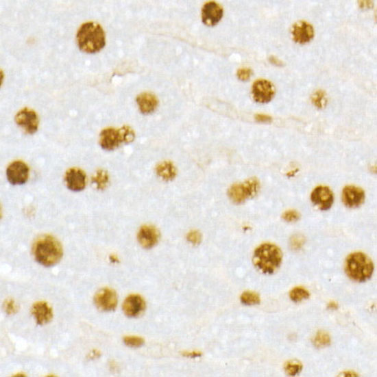 Immunohistochemistry of paraffin-embedded Mouse liver using VDR Polyclonal Antibody at dilution of 1:100 (40x lens).Perform high pressure antigen retrieval with 10 mM citrate buffer pH 6.0 before commencing with IHC staining protocol.