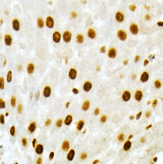 Immunohistochemistry of paraffin-embedded Rat liver using VDR Polyclonal Antibody at dilution of 1:100 (40x lens).Perform high pressure antigen retrieval with 10 mM citrate buffer pH 6.0 before commencing with IHC staining protocol.