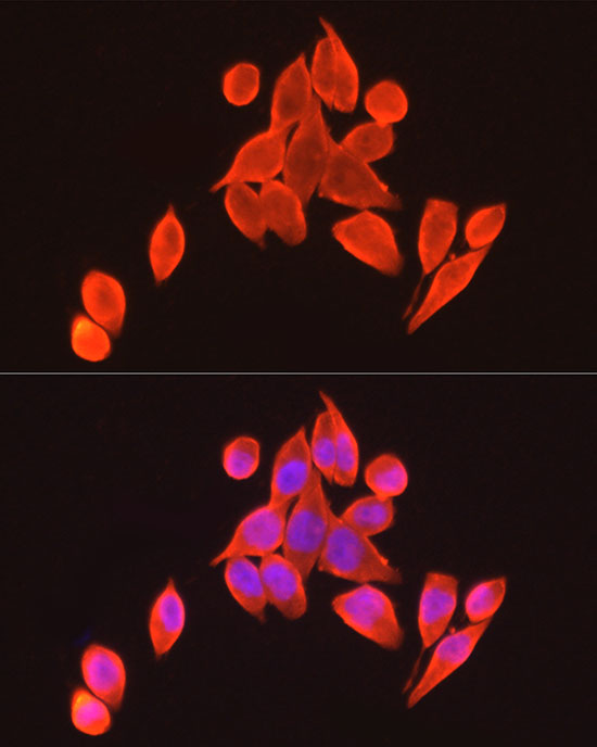 Immunofluorescence analysis of HeLa cells using VDR Polyclonal Antibody at dilution of 1:100 (40x lens). Blue: DAPI for nuclear staining.