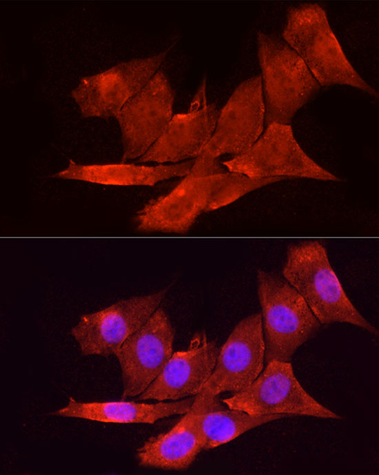 Immunofluorescence analysis of NIH/3T3 cells using VDR Polyclonal Antibody at dilution of 1:100 (40x lens). Blue: DAPI for nuclear staining.